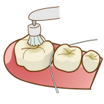予防歯科とはそもそも何を目指しているのか？